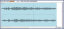 Ringtone